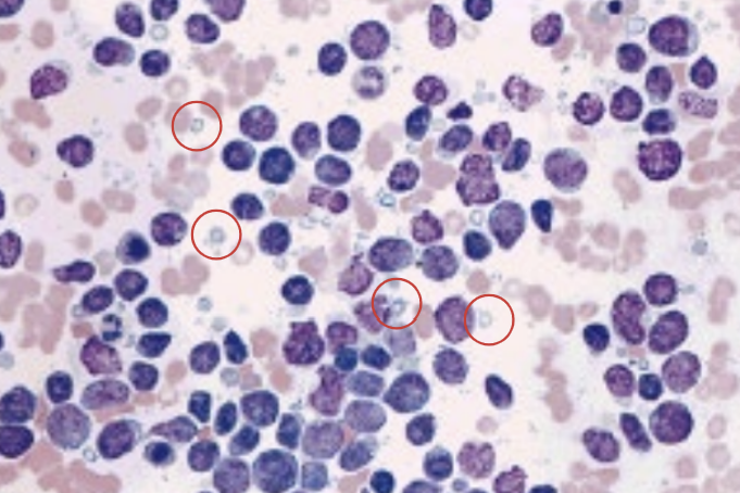 Lymphoglandular body(LGB)